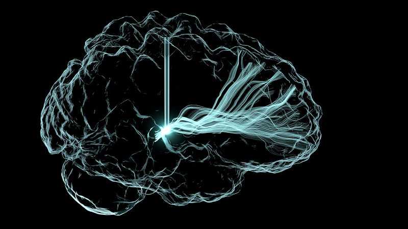 Deep Brain Stimulation Illustration -  
This image is an artistic rendering of deep brain stimulation (DBS), an approach now under clinical investigation to treat cognitive impairment that can arise after a traumatic brain injury and other conditions.
The vertical lines represent wire leads with a single electrode that has been inserted deep within the brain to reach a region involved in cognition, the central thalamus. The leads are connected to a pulse generator, a pacemaker-like device that has been implanted in a patient’s chest (not shown).  The leads’ electrode emits electrical impulses that stimulate a network of neuronal fibers (blue-white streaks) involved in arousal, which is an essential component of human consciousness. The hope is that DBS will improve attention and reduce fatigue in people with serious brain injuries that are not treatable by other means.
This image won first place in the still image category of the BRAIN Initiative’s “Show Us Your Brain Contest!”

Read more: <a href='https://directorsblog.nih.gov/2019/08/01/the-amazing-brain-deep-brain-stimulation/' rel='noreferrer nofollow'><p id=